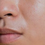 Tips Ampuh Mengatasi Kulit Berminyak agar Bebas Kilap Seharian
