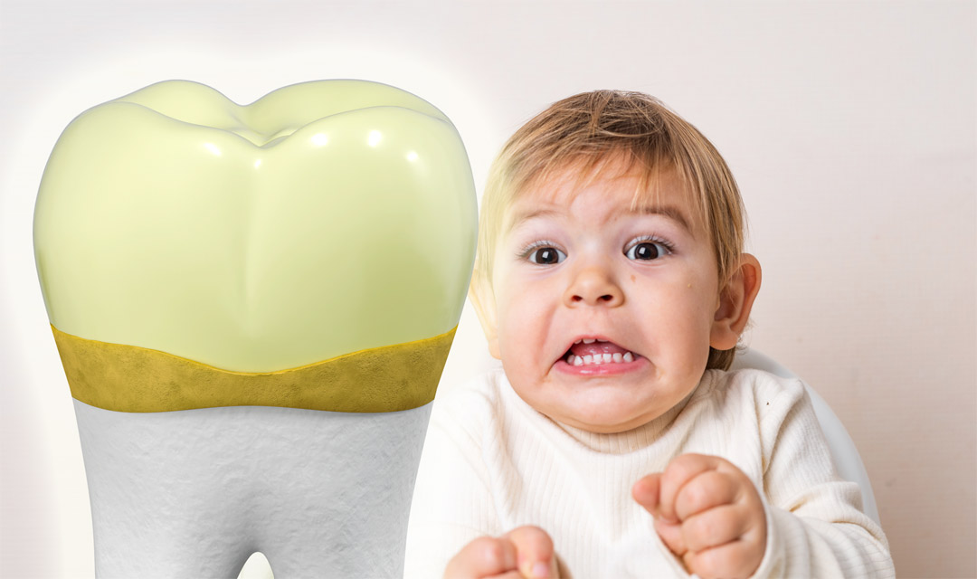 10 Tips Penting agar Anak Terhindar dari Karang Gigi