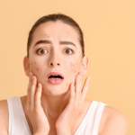 10 Kebiasaan Sehari-hari yang Bisa Bikin Jerawat Betah
