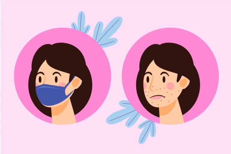 10 Cara Menghindari Jerawat Akibat Masker (Maskne)