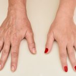 7 Cara Mencegah Penuaan Dini di Area Tangan