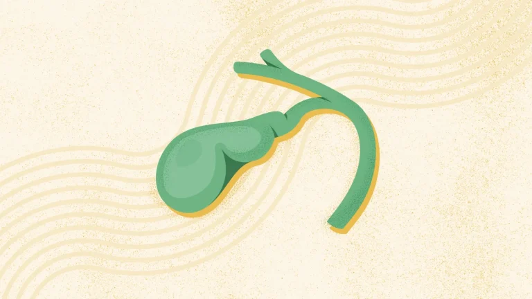 7 Cara Mencegah Batu Empedu dengan Pola Hidup Sehat